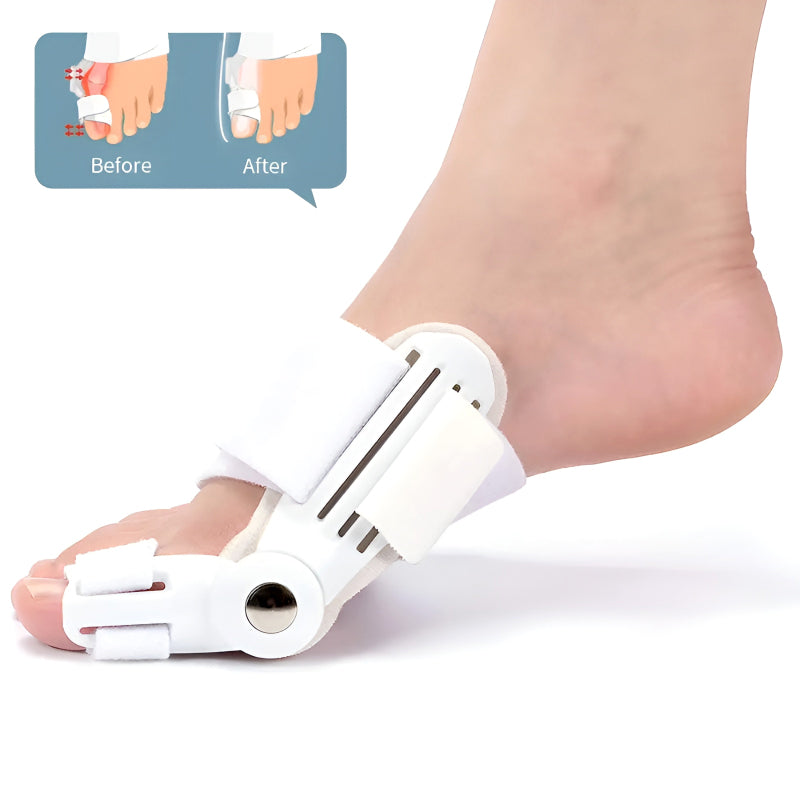 Bunion Splint and Big Toe Straightener – Orthopedic Hallux